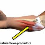 Prevenir Lesiones en Golf